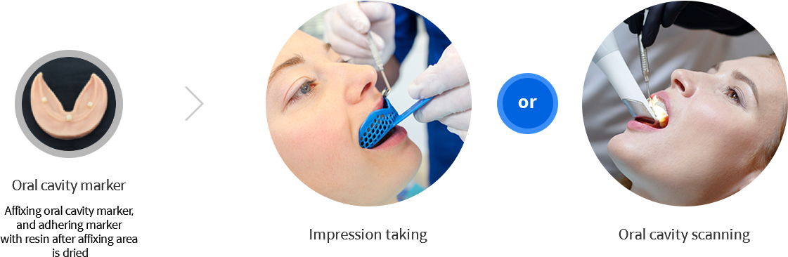 Impression taking Maker, Impression taking, Oral cavity scanning